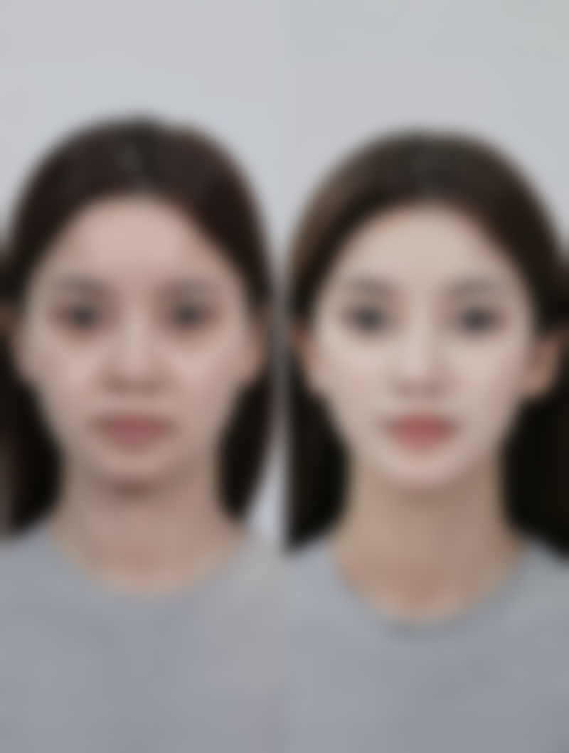 西安莎曼妃整形医疗美容医院朴俊医生口碑评价与项目分享：