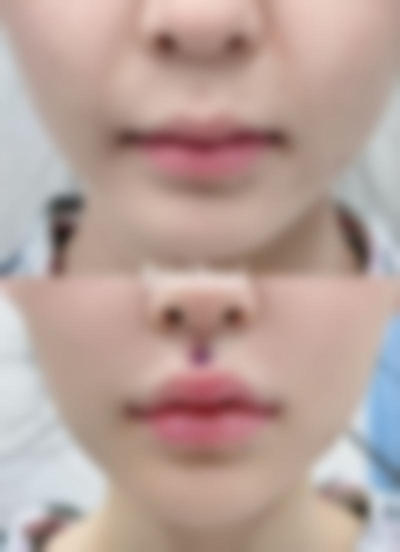 谢冉医生的技术实力