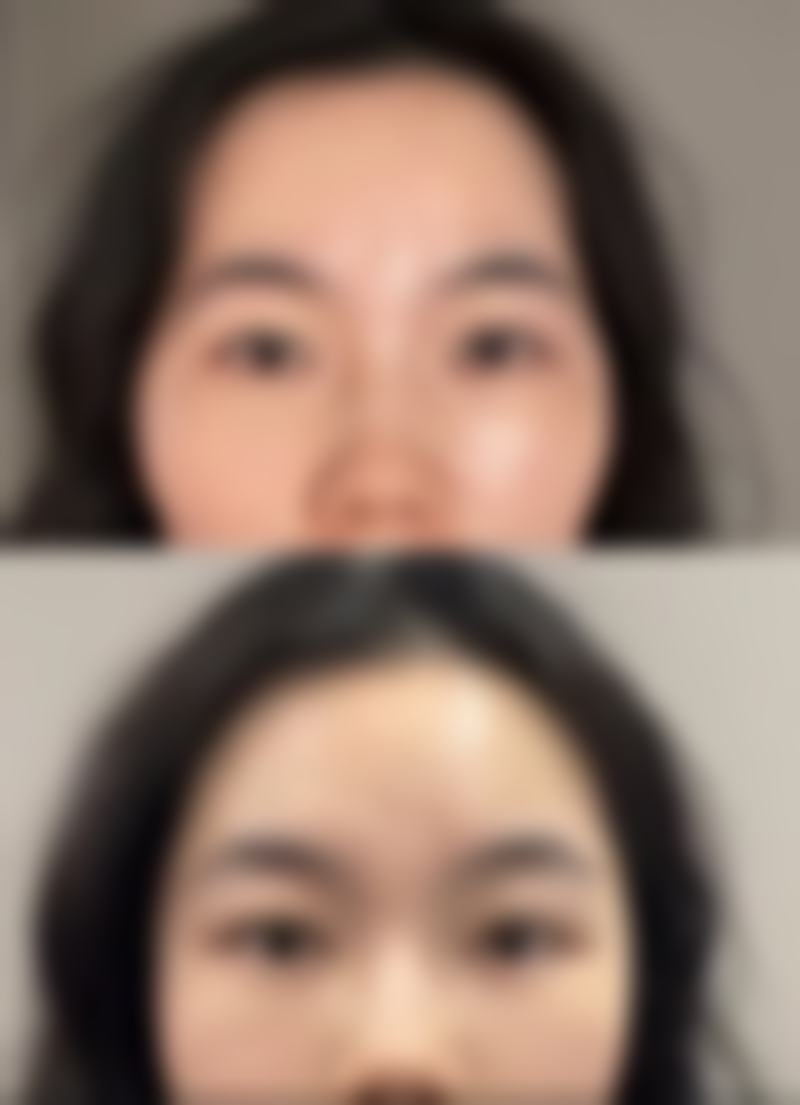 天津南开兰积整形医院治疗反馈与口碑评价。