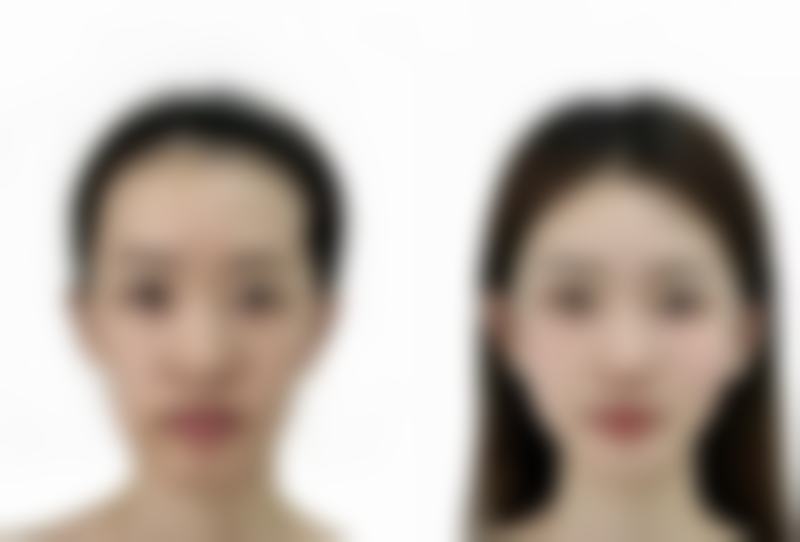 阜新矿业集团总医院烧伤整形科擅长项目