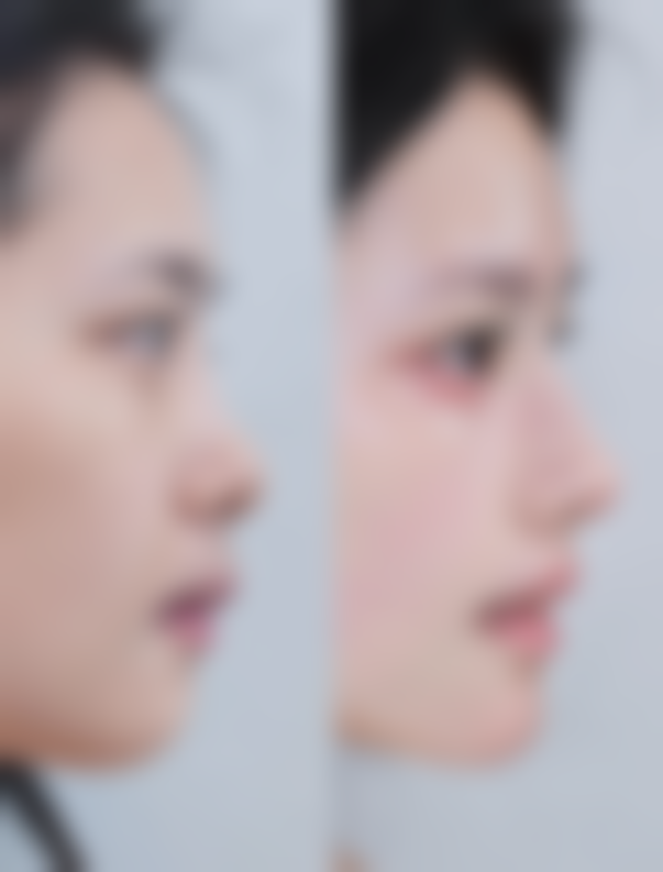 杭州花季整形医院上班时间