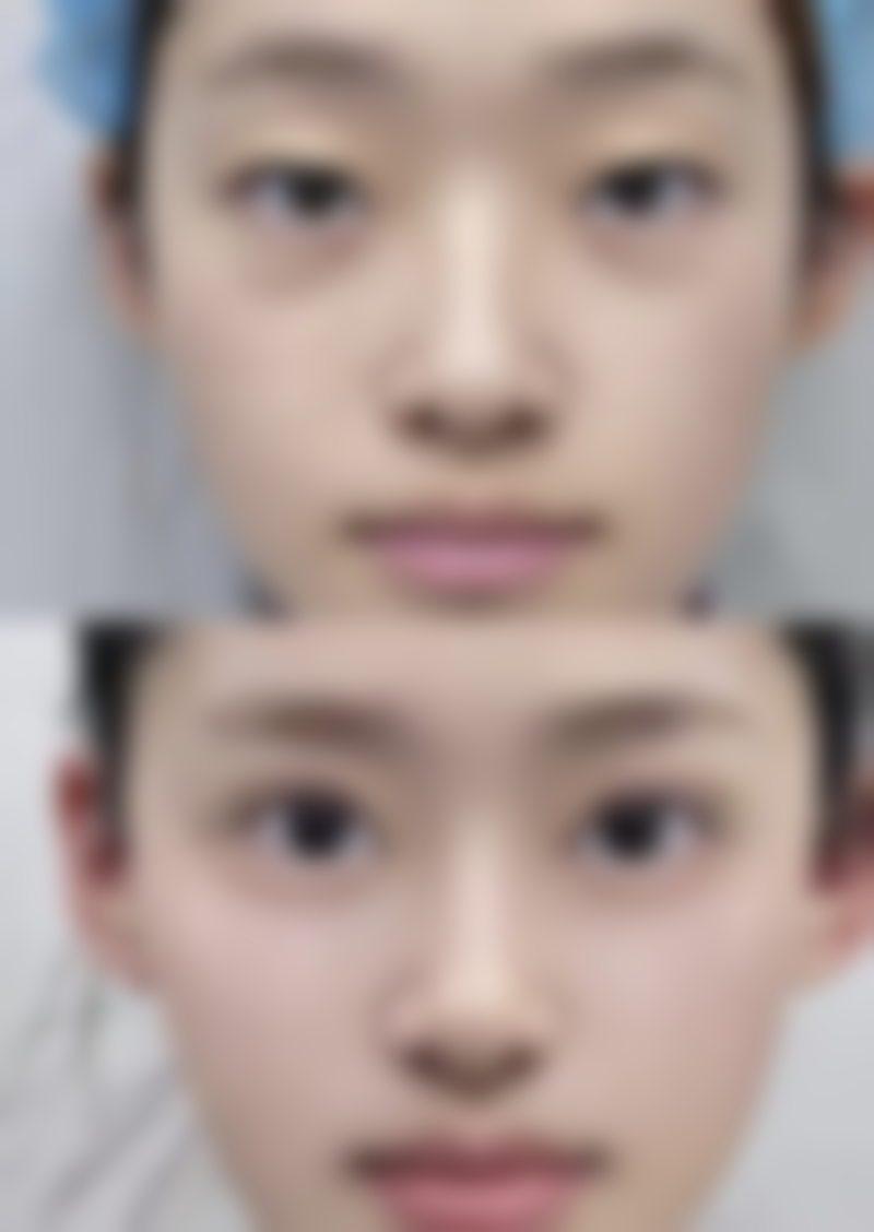 库尔勒奥蕊斯整形医院擅长项目有哪些？