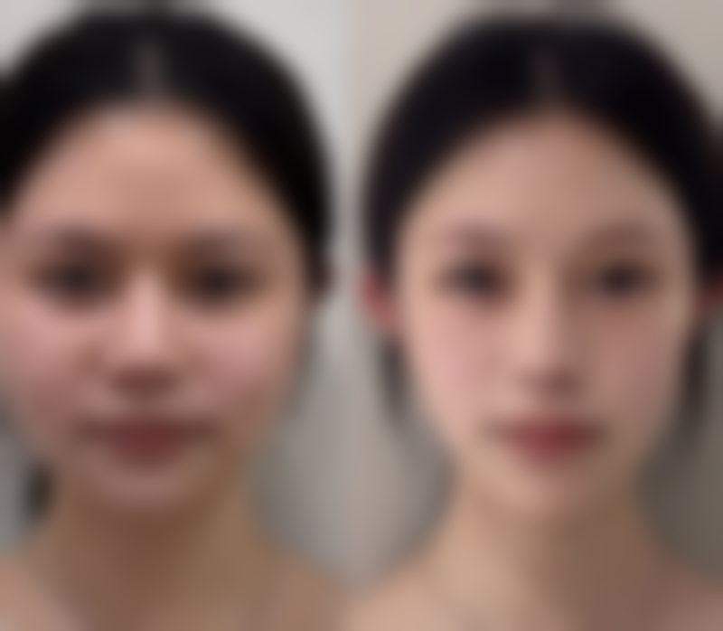 成都德肤研整形医院治疗反馈与口碑评价。