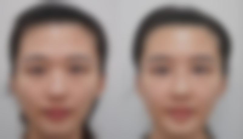 蚌埠韩美美莱医疗美容门诊部的项目价格