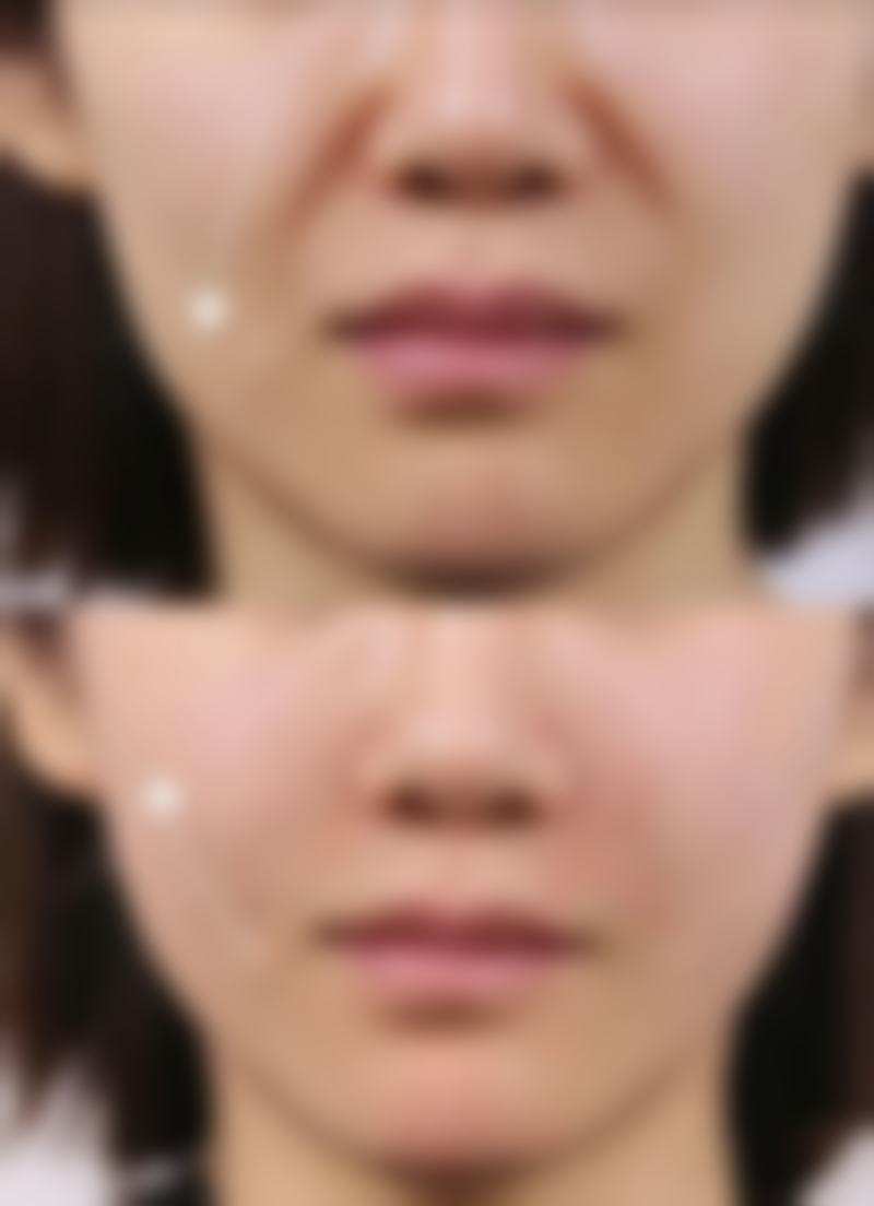 大连李鲁阳整形门诊地理位置便于到院。