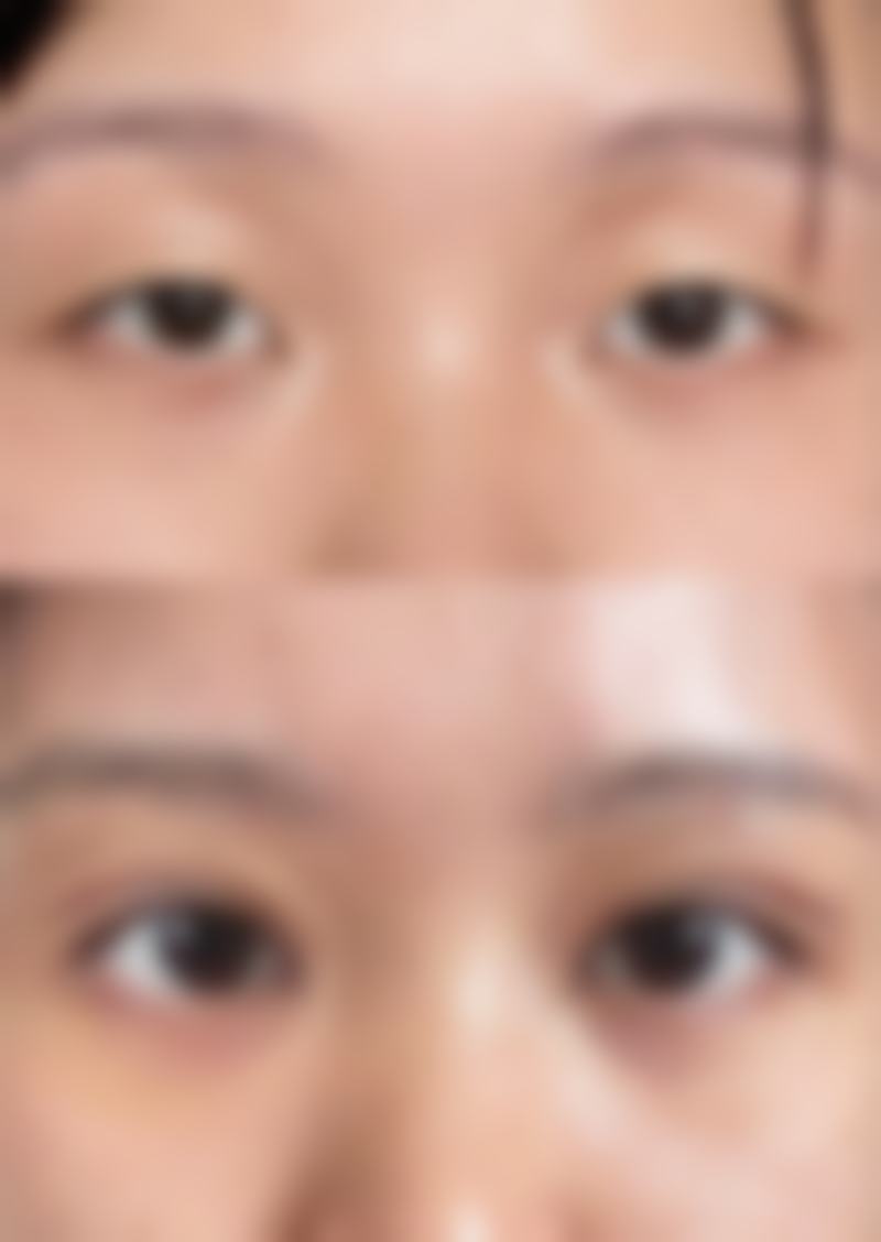 武汉瑞美淇整形医院2026年价格收费表：