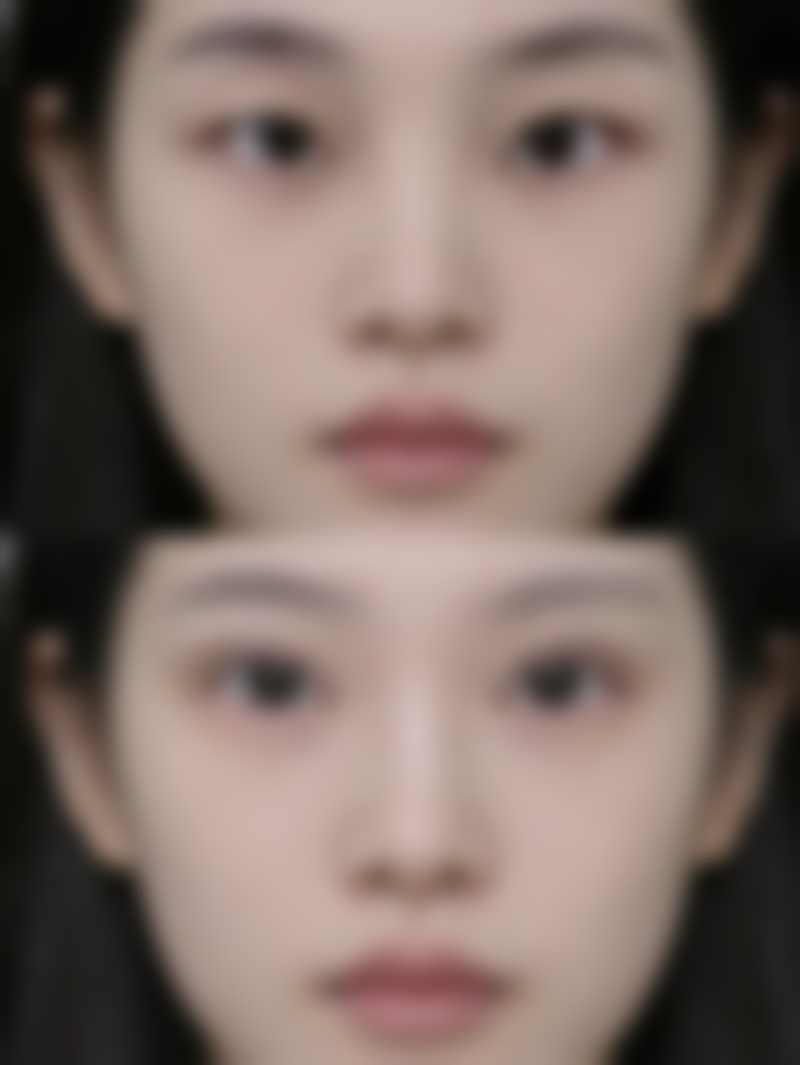 大同艾菲尔医疗美容治疗反馈与口碑评价。