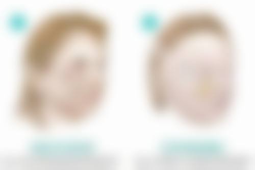 淮北奥斯曼医疗美容整形医院擅长项目