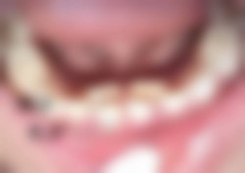 韩国GOOD LINE崔德浩整形外科上班时间