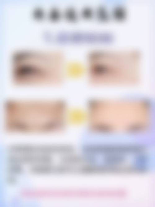 新余四良整形医院预约挂号