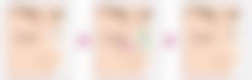 邢台臻悦医疗美容门诊部王僧会医生预约挂号