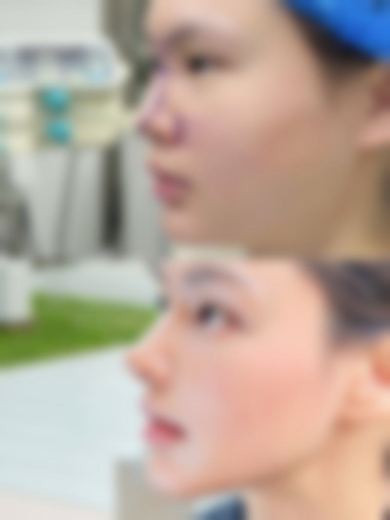 何荣国医生的技术实力