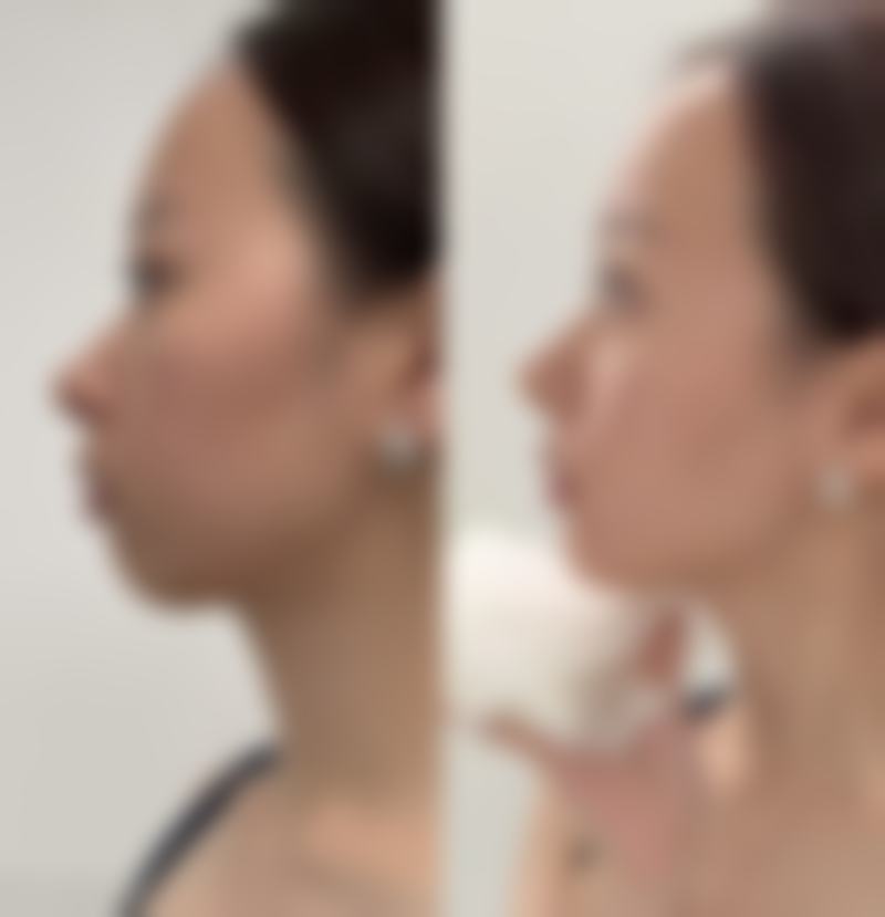 阜阳市琴瑟医疗美容门诊部2026年价格收费表：