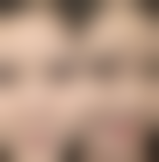 淮北奥斯曼医疗美容整形医院地址：