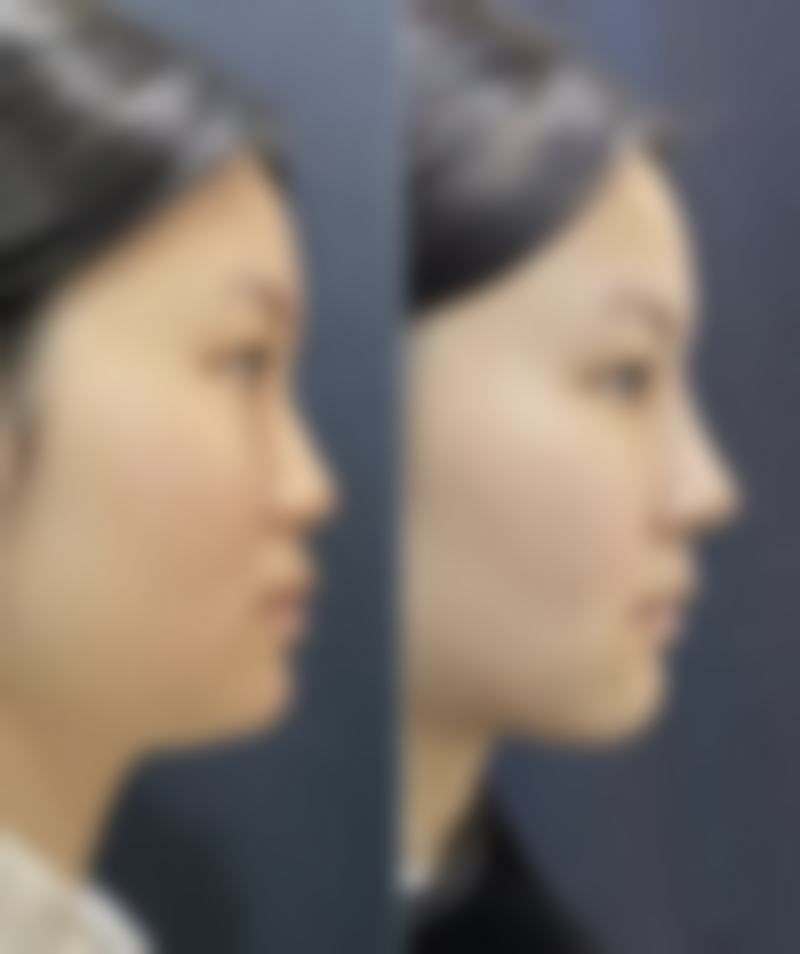 深圳同仁整形医疗美容医院的项目优势