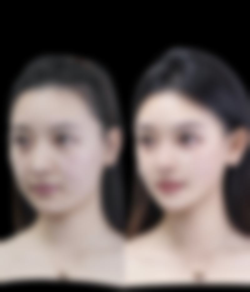 韩国PT（pretty）整形外科擅长项目。