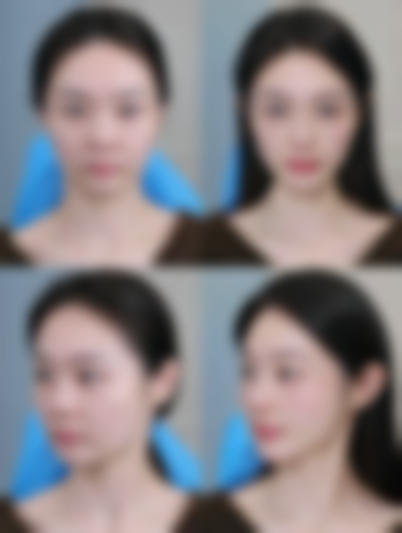 广州市第十二人民医院整形美容科项目价格