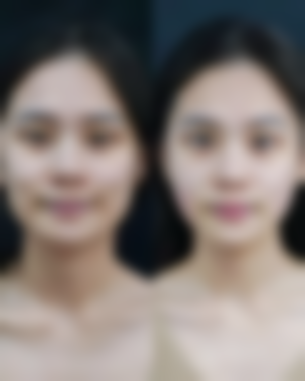 新余四良整形医院口碑评价与项目分享：