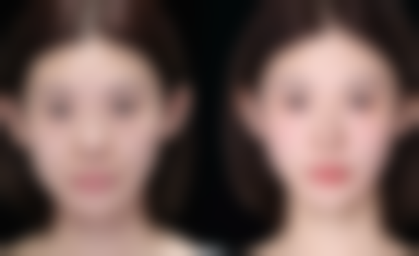 唐娟医生技术与实力展现