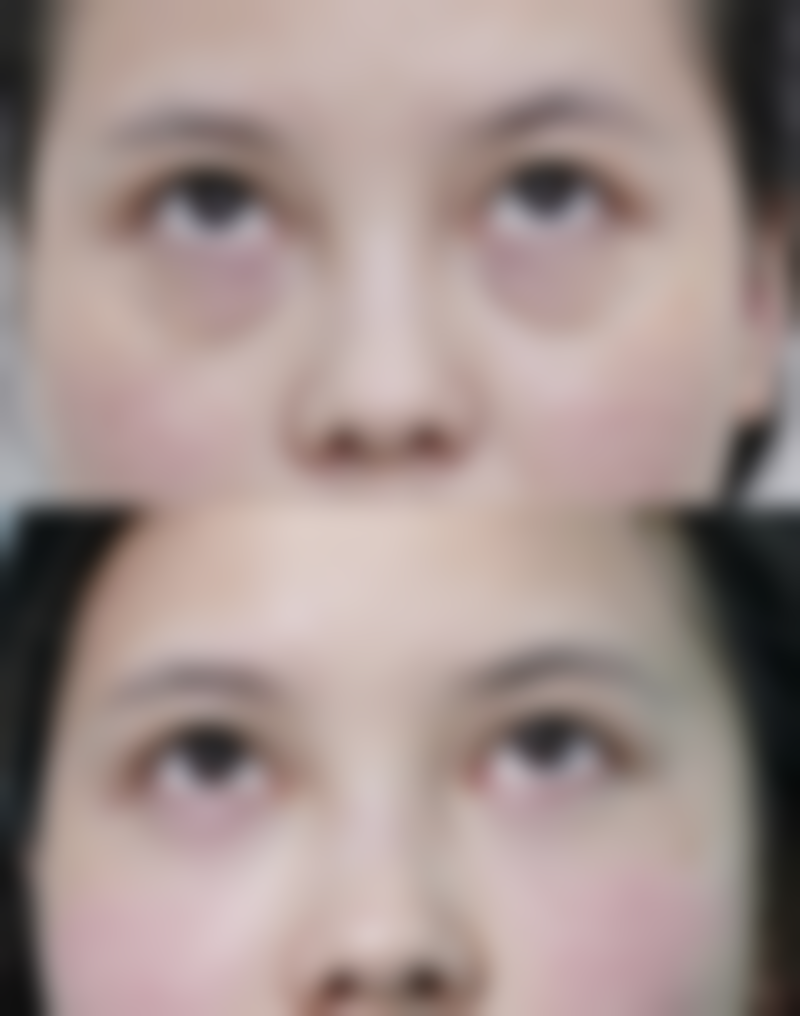 韩国PT（pretty）整形外科预约挂号方式。