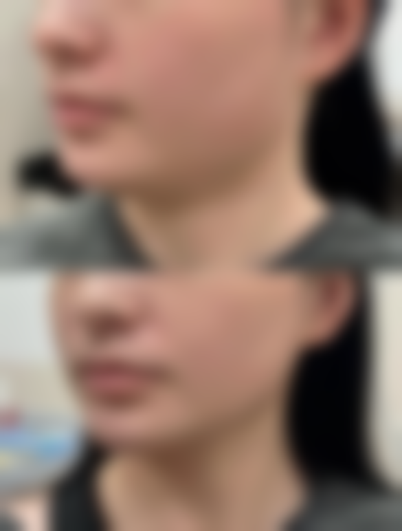 韩国GOOD LINE崔德浩整形外科口碑评价与项目分享