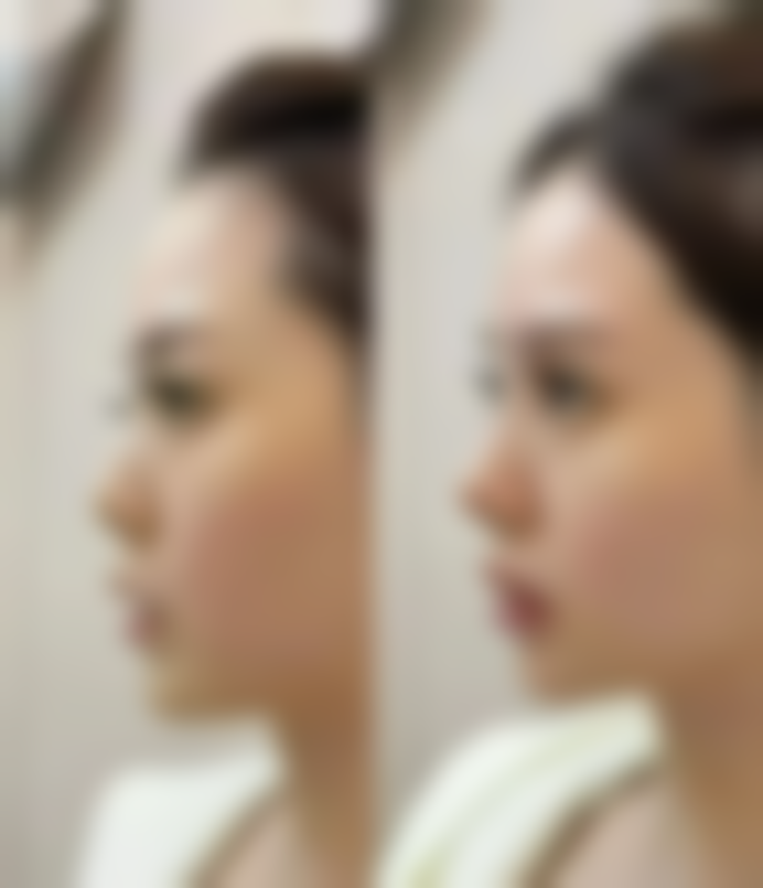 西安莎曼妃整形医疗美容医院擅长项目