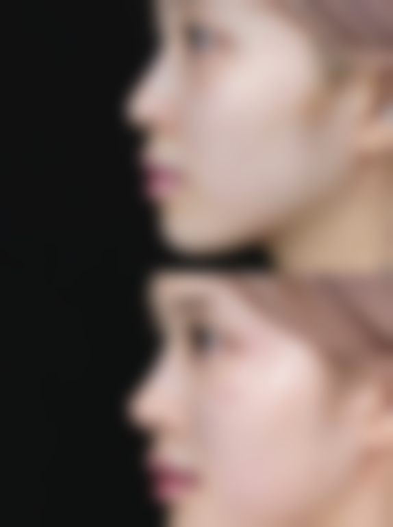 何荣国医生擅长的项目