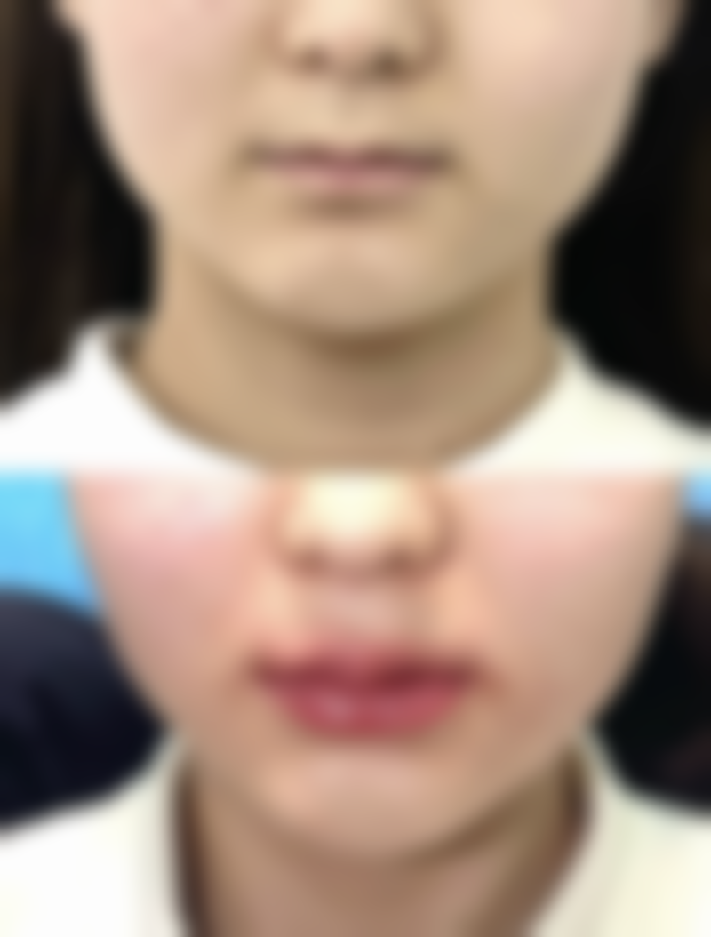 朴俊医生技术实力体现