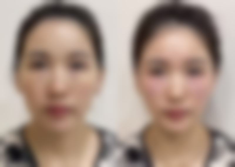 西安莎曼妃整形医疗美容医院擅长项目