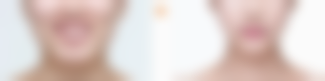 尹洪祥医生的技术与实力体现