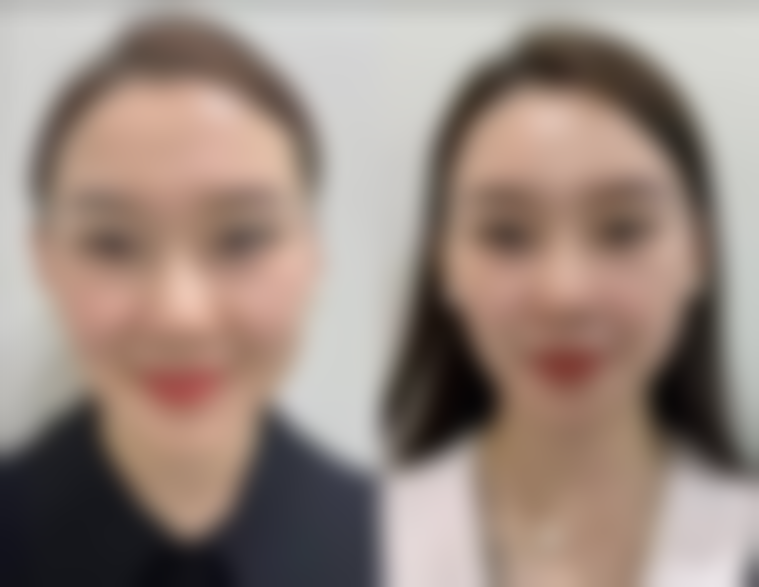 大连卓悦美慧医疗美容诊所擅长项目。