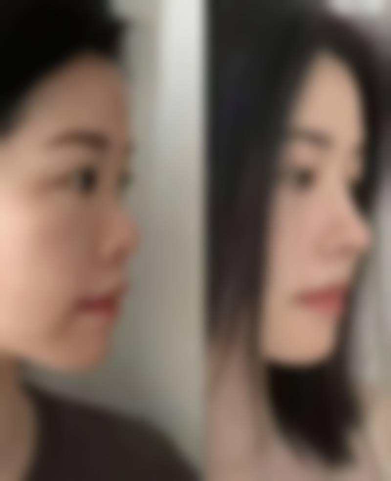 朱小平医生的擅长项目