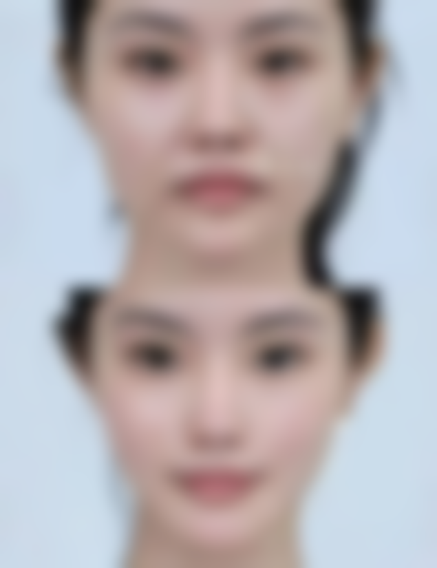 兰州时光激光整形医院（西北旗舰总院）口碑评价与项目分享：