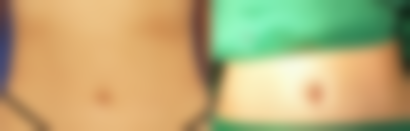 张春华医生技术实力展现