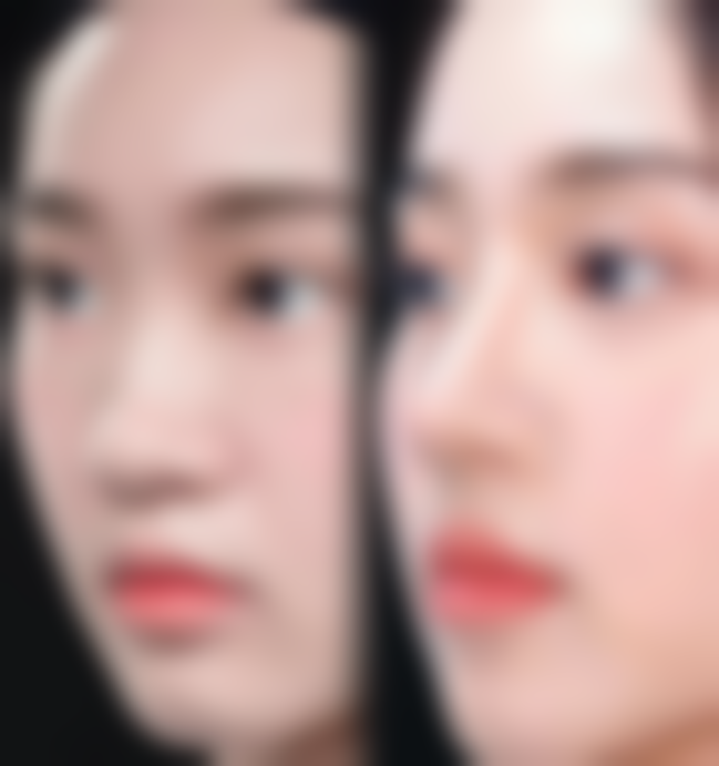 韩国PT（pretty）整形外科的口碑评价