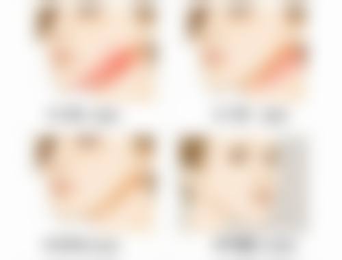 谢冉医生口碑评价与项目分享：