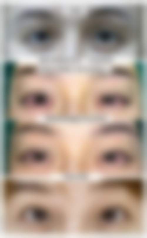  昆明赫柏整形医疗美容门诊部都颢医生技术怎么样