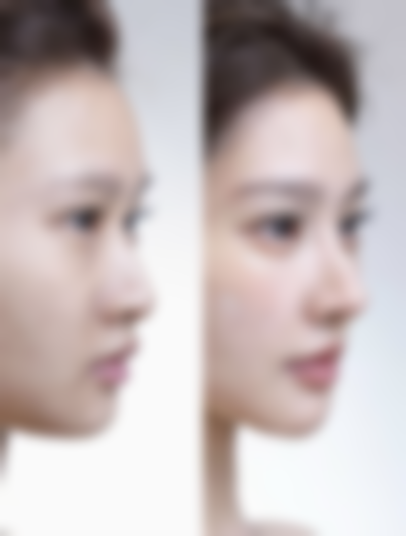 Herb 整形外科任奎卓医生价格收费表查询