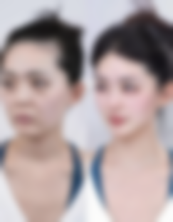 诸城华元医院皮肤美容科口碑评价与项目分享