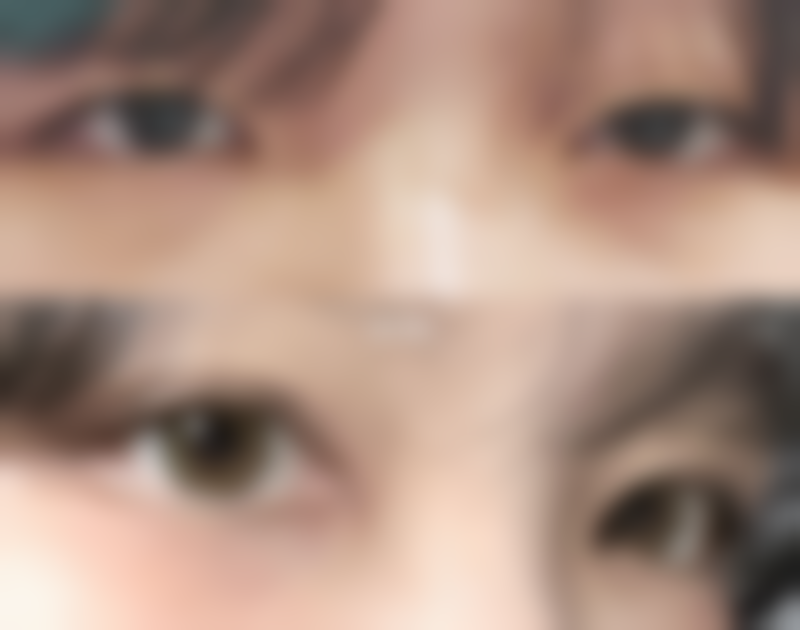 胡德芬医生的技术实力