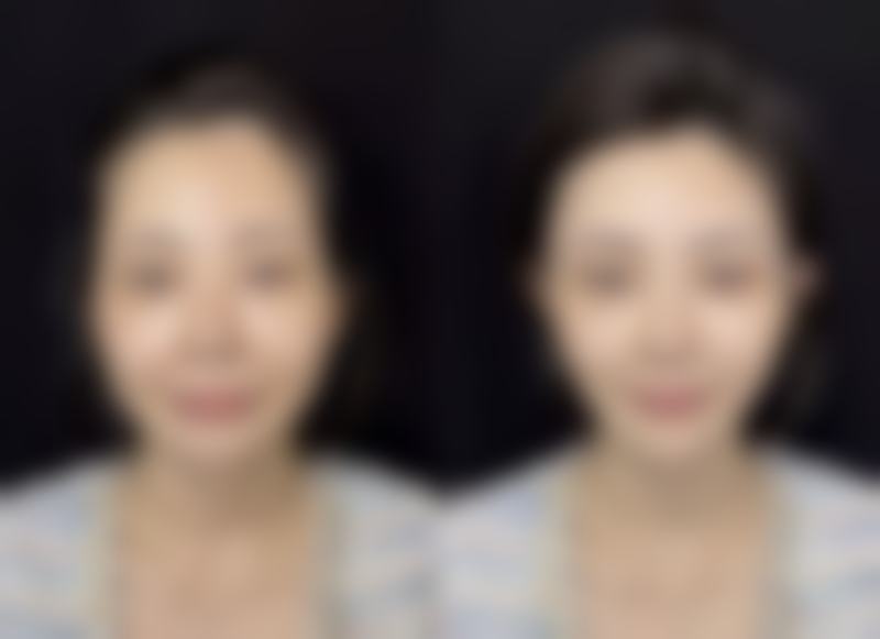 滕州美界医疗美容诊所地理位置便于到院。