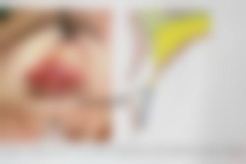 韩国faceplus菲斯普乐斯整形外科治疗反馈与口碑评价。