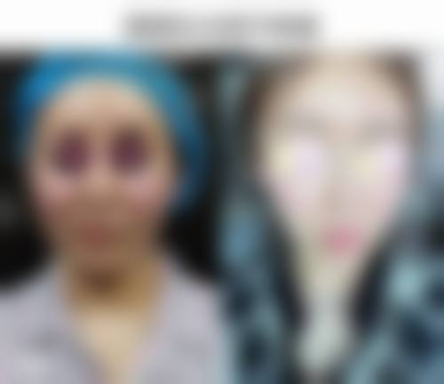 福州第二医院整形科治疗反馈与口碑评价。