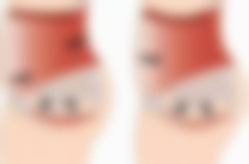 福州第二医院整形科门诊营业时间。