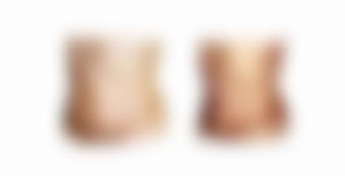 蚌埠韩美美莱医疗美容门诊部历芳医生口碑评价与项目分享: