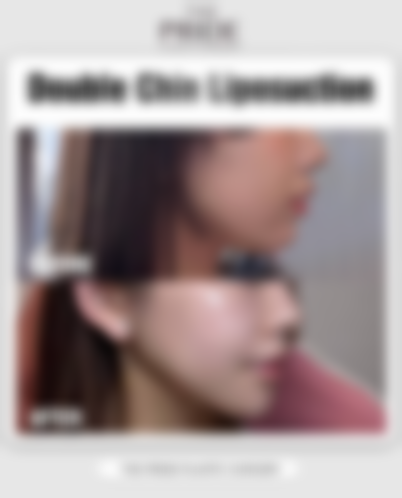 深圳广和门诊部收费价格表