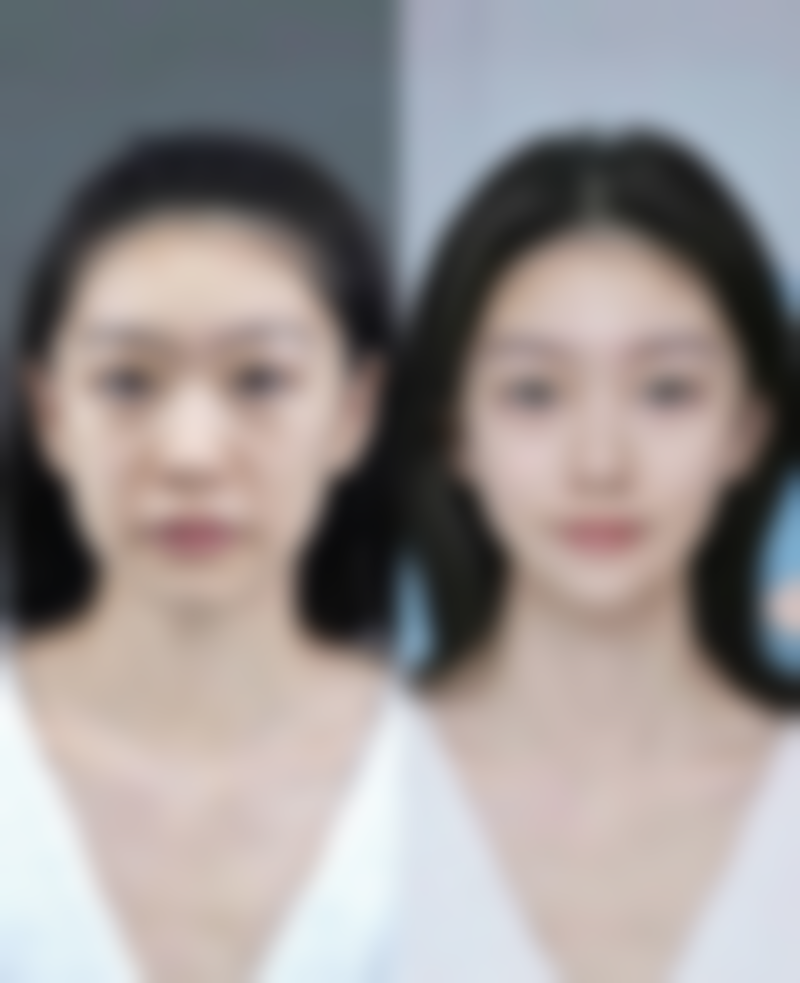 蚌埠韩美美莱医疗美容门诊部历芳医生预约挂号