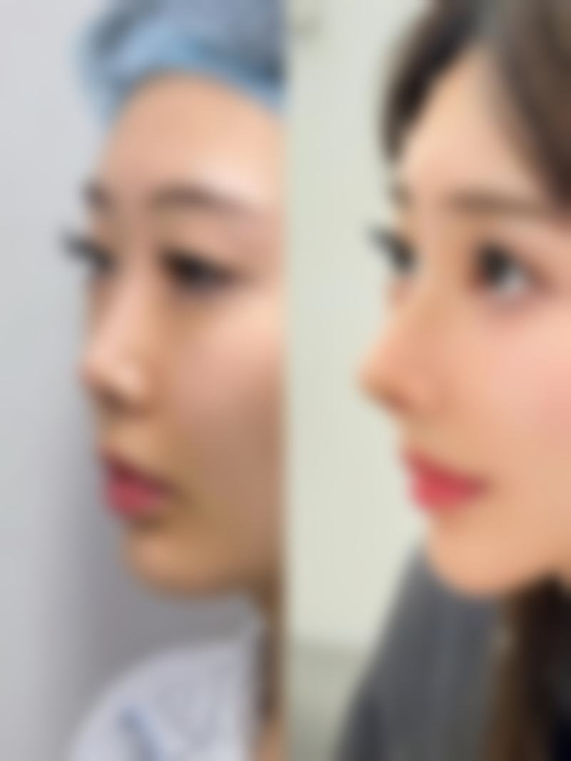 徐光锡医生擅长项目解析