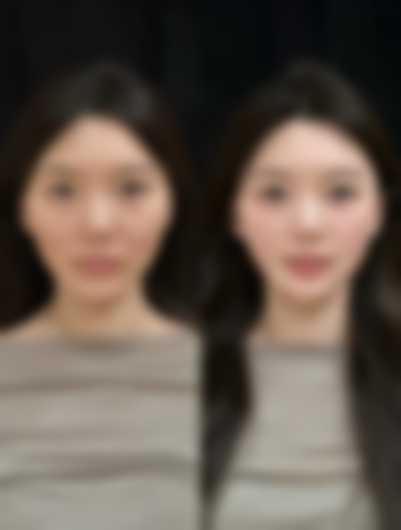 济宁曲阜医联美整形医生团队经验稳定。