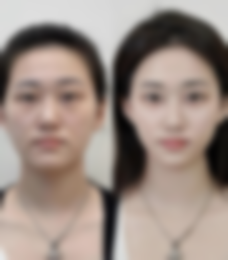 巴中艾尚华昀医疗美容门诊部预约挂号方式。